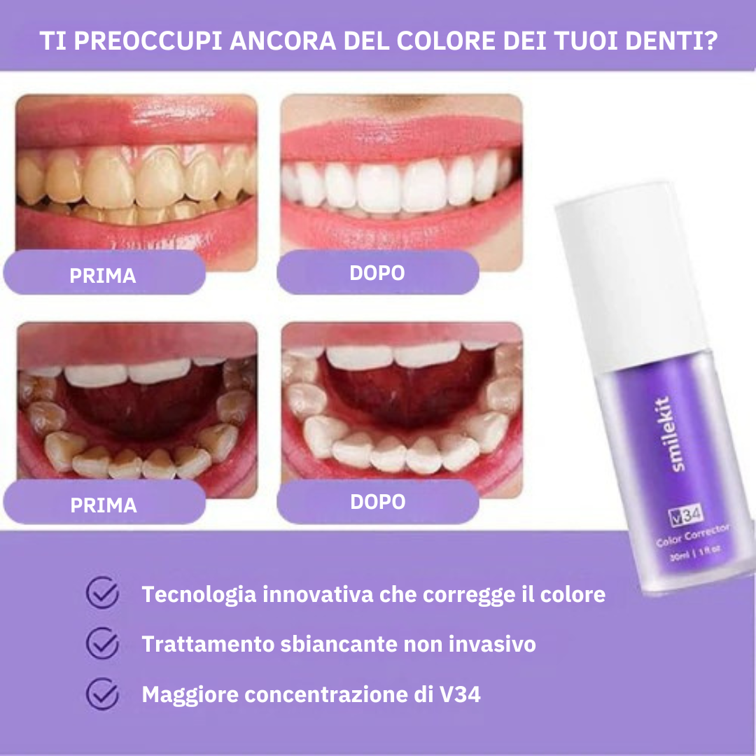 Sbiancante Dentale V34™ - TRENDFINDER® (2025)
